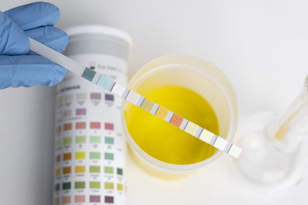 Routine Urine Tests In Pregnancy: Normal Level, Procedure, And Cost -  Queens Health